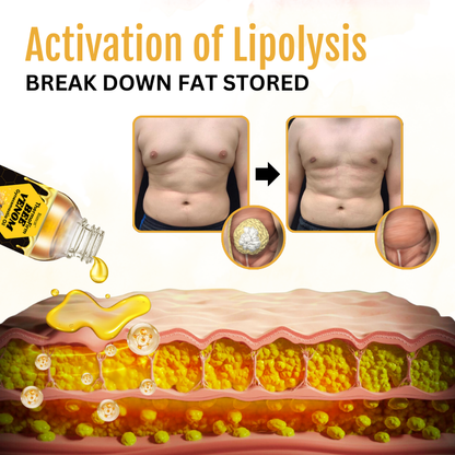 BIG SALE - ThermoFirm Bee Venom Gynecomastia Oil